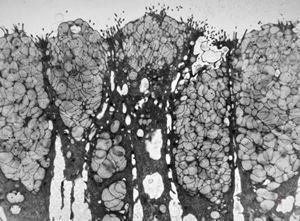 normal mucosa - stomach